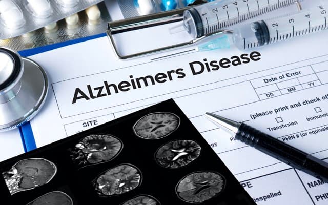 Actinogen Medical phase two Alzheimer’s clinical trial disappoints