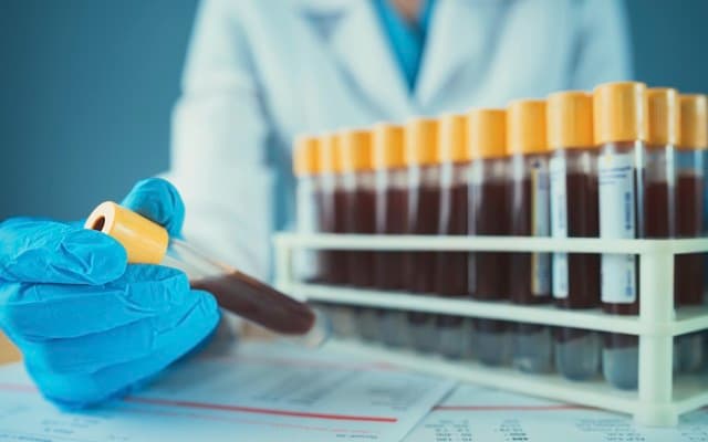 Biotron’s BIT225 drug show to enhance body’s immune response to HIV