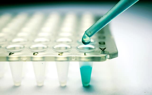 Cynata Therapeutics looks to advance Cymerus stem cell treatment into phase 2 trials