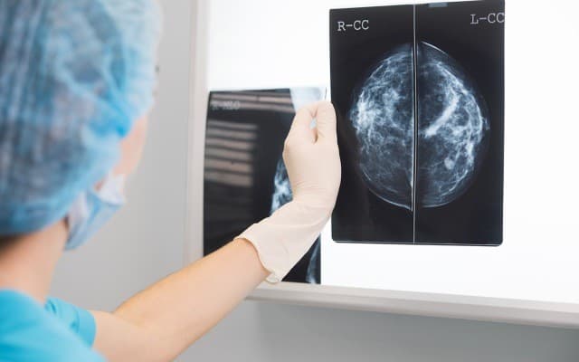 Genetic Technologies works with University of Melbourne to expand breast cancer test to women with hereditary risk