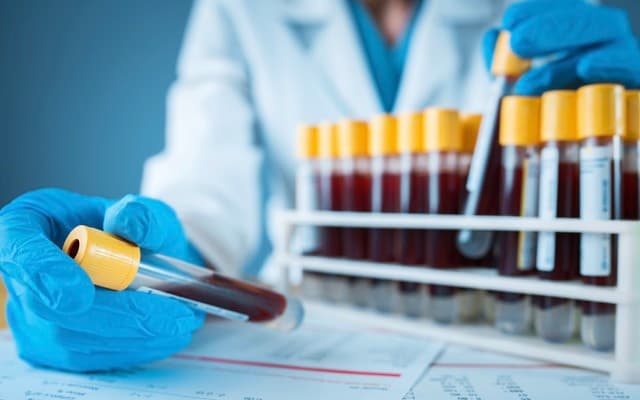 Rhythm Biosciences reports positive results for lead biomarker in blood test for colorectal cancer screening